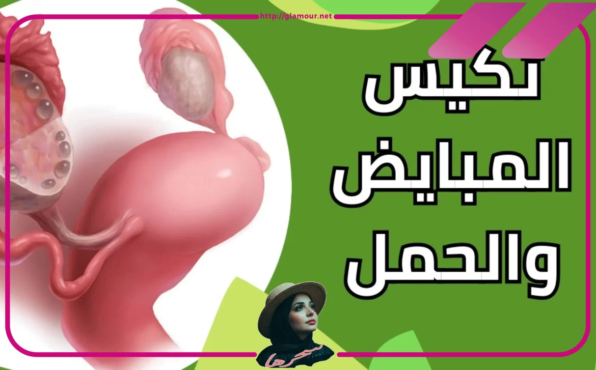 أعراض تكيس المبايض
