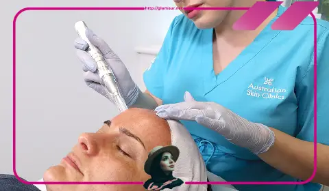 الليزر البارد