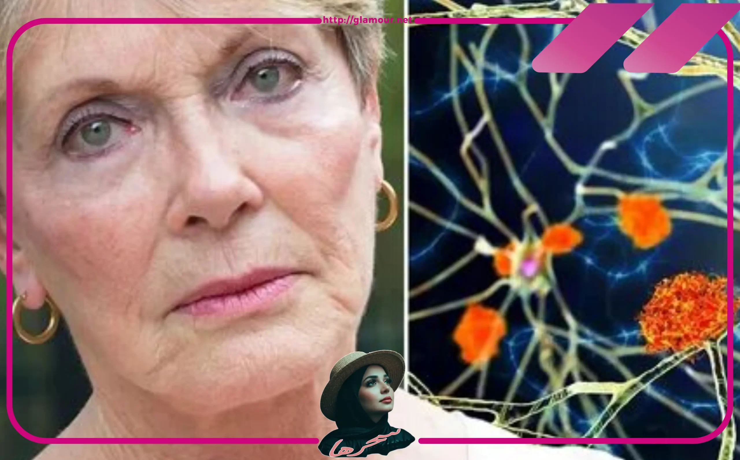 أعراض الزهايمر عند النساء